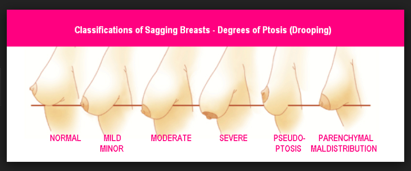 pencil breast test