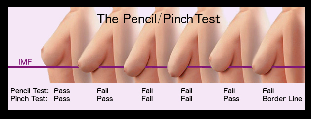 how to do the pencil test for breasts