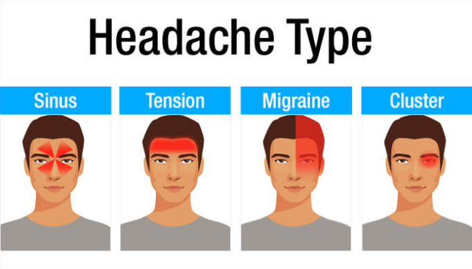 Headache Diagram | Wiring Diagram