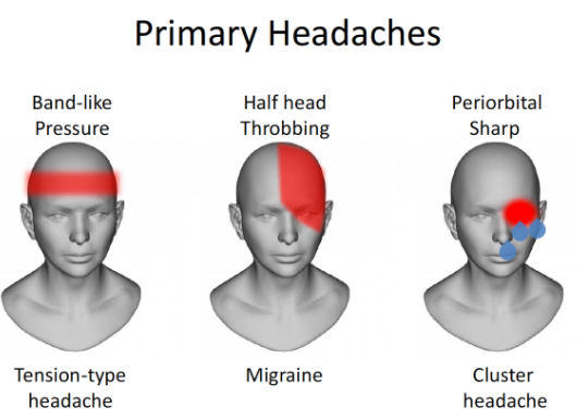 Different Headaches Chart