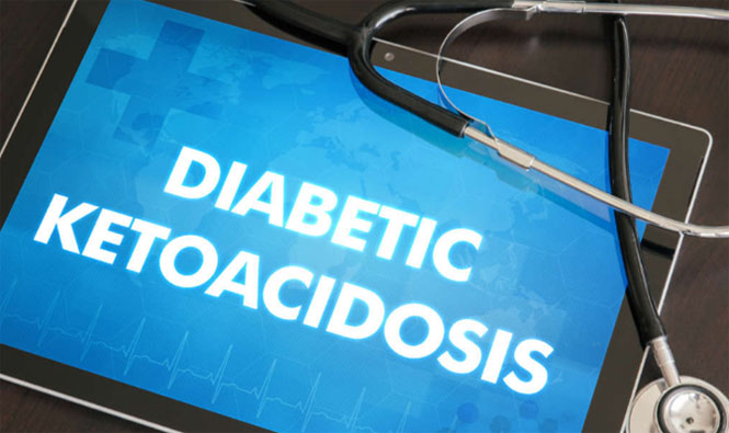 Diabetic Ketoacidosis : Causes, Symptoms and Treatments