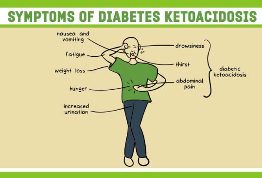 Diabetic Ketoacidosis symptoms pictorial presentation 